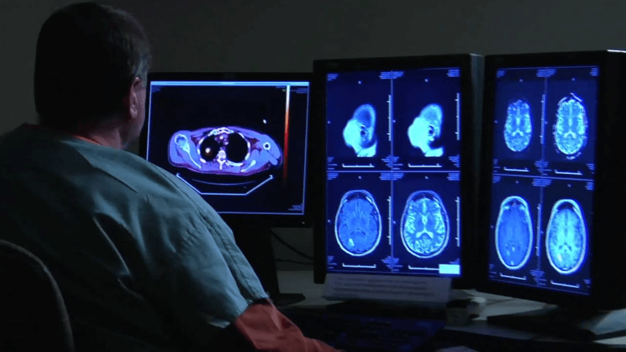 IBM Watson Health Unveils Imaging AI Marketplace of FDA-Cleared Solutions